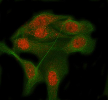 Anti-RBM12B / RNA-binding protein 12B