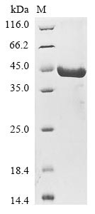 Sestrin-3 (SESN3), human, recombinant