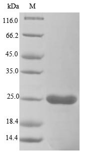 Entry-fusion complex associated protein OPG095 (OPG099), partial, Vaccinia virus, recombinant