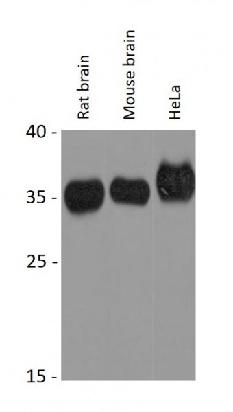 Anti-STUB1 / CHIP