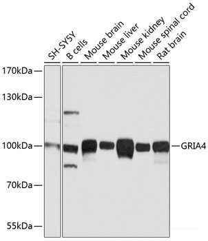 Anti-GluR4