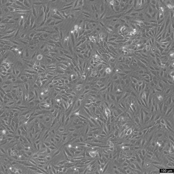 TCCSUP Cells