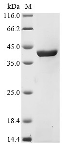 Aspartate carbamoyltransferase (pyrB), Escherichia coli O45:K1, recombinant