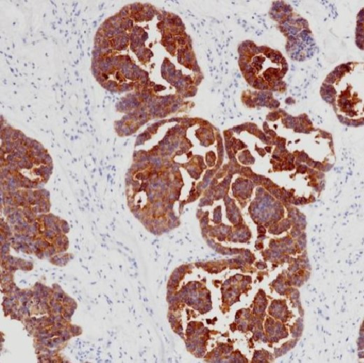 Anti-Claudin 6, clone SQab30353