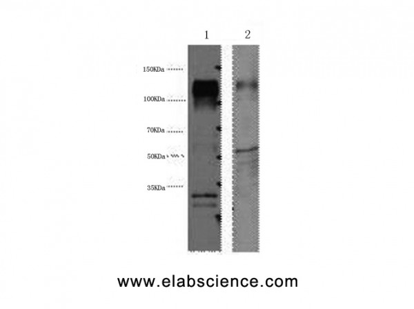 Anti-ERBB2, clone 1J5
