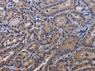 Anti-TRPM8