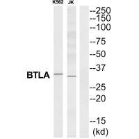 Anti-BTLA