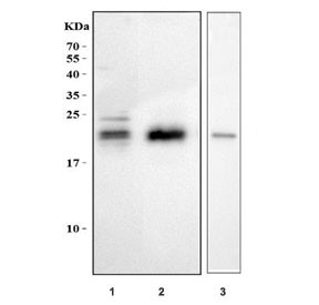 Anti-MAX / MYC associated factor X