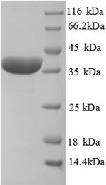 Haptoglobin (Hp), partial, rat, recombinant