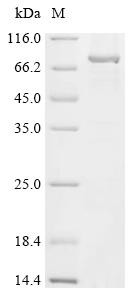 Polypeptide N-acetylgalactosaminyltransferase 3 (Galnt3), mouse, recombinant