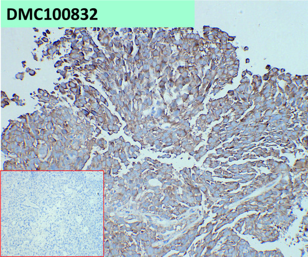 Anti-ADAM9 antibody(45G10), IgG1 Chimeric mAb