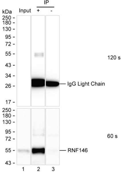 Anti-RNF146 Magnetic Beads