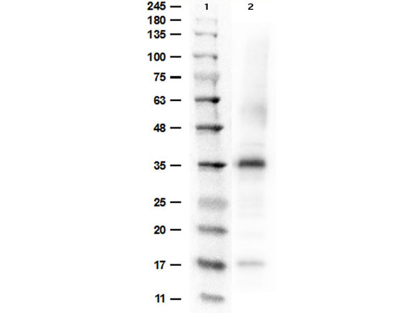 Anti-ARGINASE