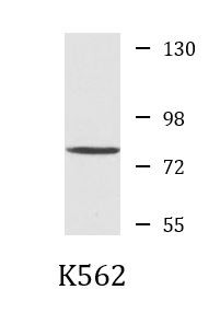 Anti-ADRBK2