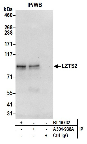 Anti-LZTS2