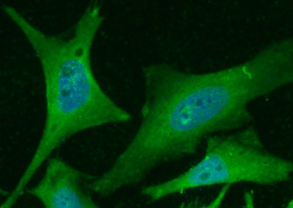 Anti-PHPT1 Monoclonal Recombinant Antibody