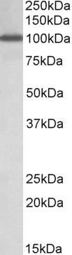 Anti-NUP107, Internal