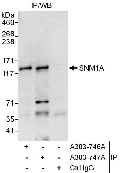 Anti-SNM1A