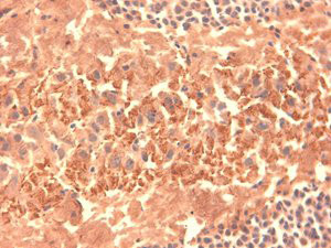 Anti-HCN4, clone S114-10