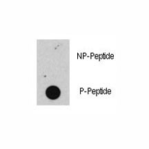 Anti-phospho-Rb (Ser608)