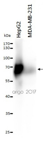 Anti-alpha Fetoprotein, clone AFP-Y2