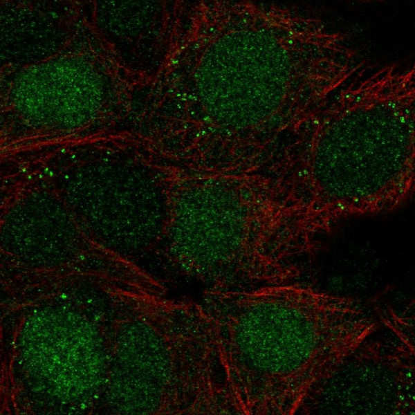 Anti-TPI1