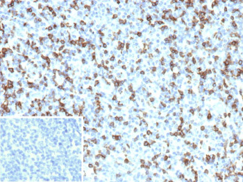 Anti-FCGR1A / High affinity immunoglobulin gamma Fc receptor I, clone FCGR1A/7499