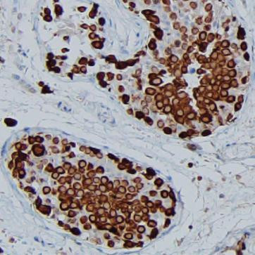 Anti-HSP90AA1