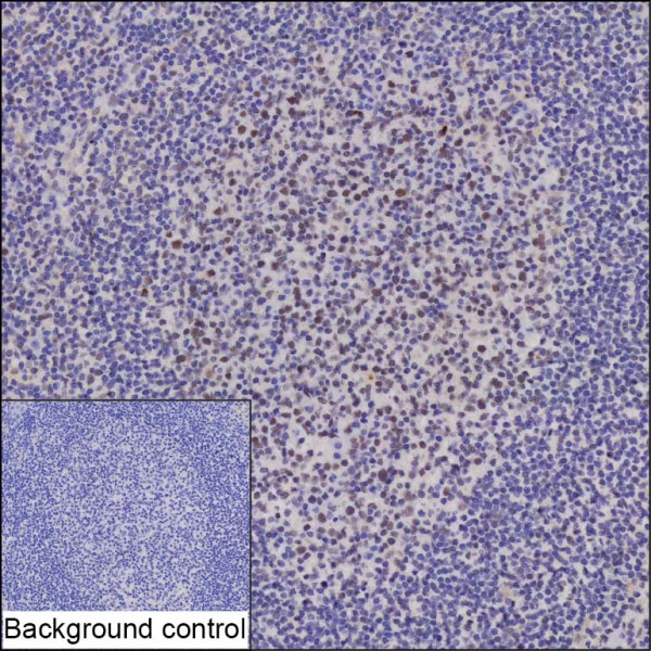SETD2 antibody