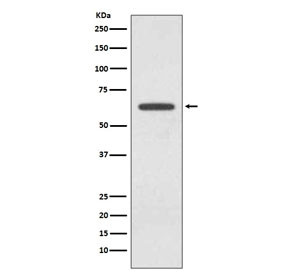 Anti-Glutaminase / GLS, clone FIA-7