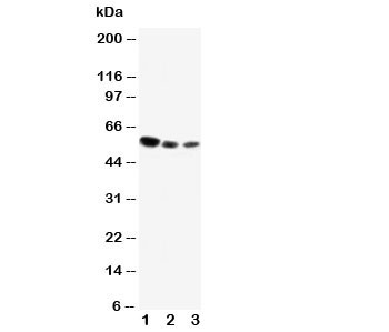 Anti-CD89