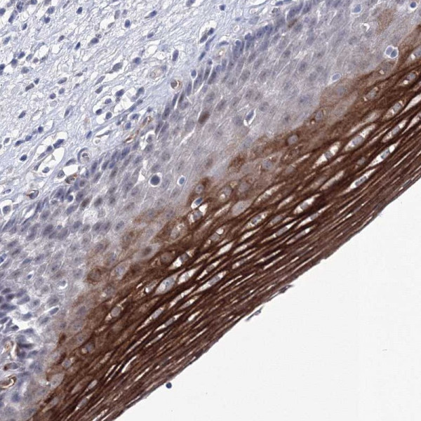 Anti-ACOX3