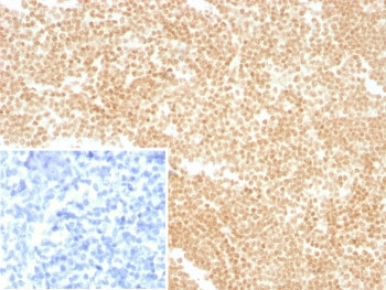 Anti-LDB2 / LIM domain binding 2, clone PCRP-LDB2-1B10