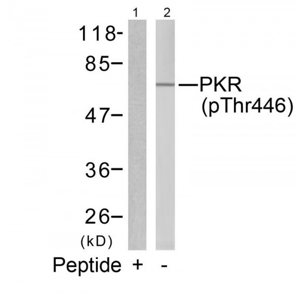 Anti-phospho-PKR (Thr446)