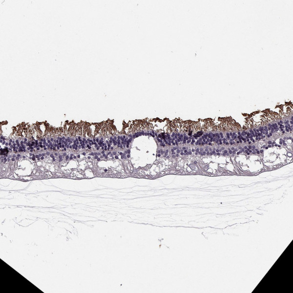 Anti-CACNA1F