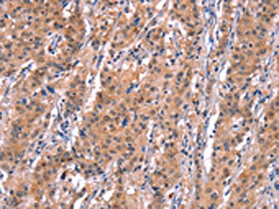 Anti-BCL6