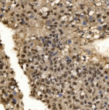Anti-CPSF6 / CFIm68