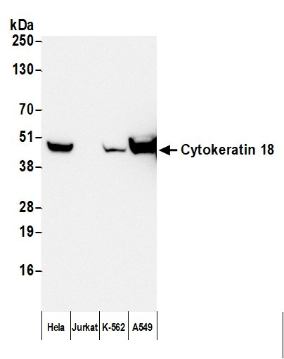 Anti-Mouse IgG1 cross-adsorbed, HRP conjugated