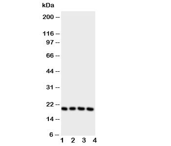 Anti-LCN1