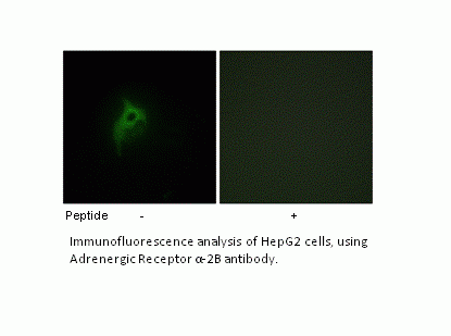 Anti-Adrenergic Receptor alpha-2B