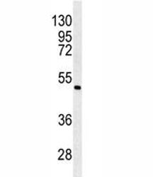 Anti-ANGPTL6