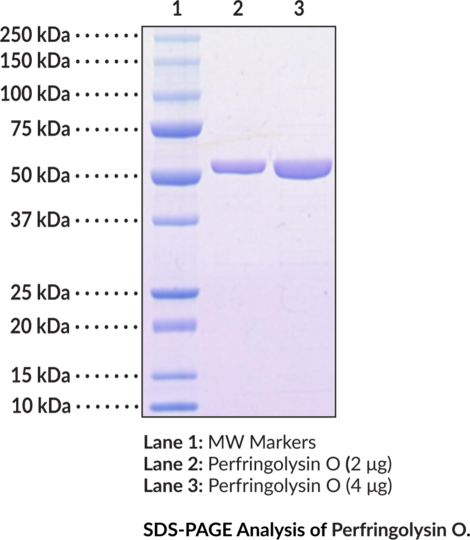Anti-Perfringolysin O (C459A mutant, C. perfringens, recombinant)