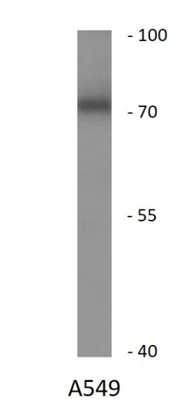 Anti-MAN1A1