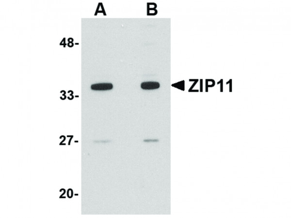 Anti-ZIP11