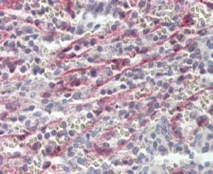Anti-Stabilin 1