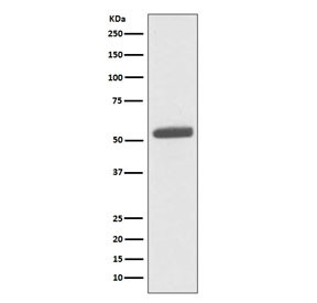 Anti-Pyruvate Kinase / PKM2, clone GCB-16