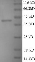 Minor capsid protein VP2, BK polyomavirus, recombinant