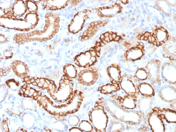Anti-Ksp-Cadherin (Kidney-Specific Cadherin) / CDH16, recombinant antibody, clone CDH16/1532R