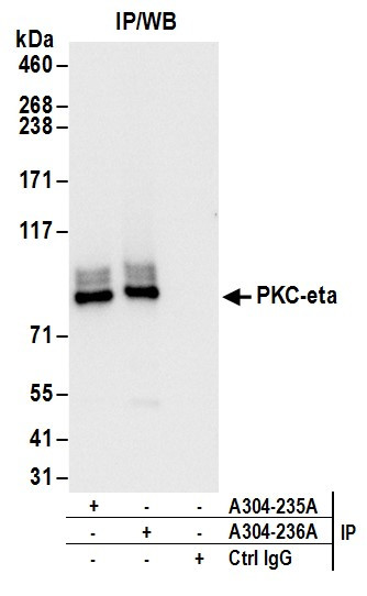 Anti-PKC-eta