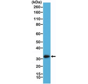 Anti-Calretinin / Calbindin 2 / CALB2 (recombinant antibody), clone RM324